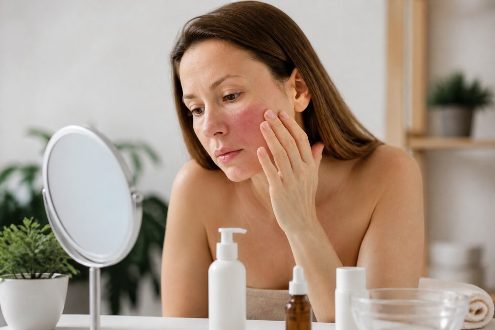 Skincare for Extremely Sensitive Skin Explained